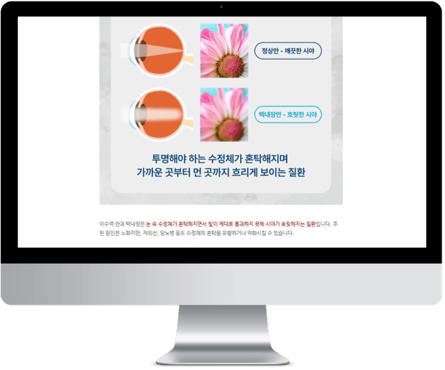비교 영역
